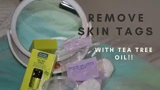 How to Remove Skin Tags Naturally with Tea Tree Oil