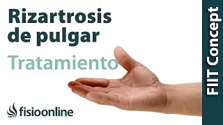 Rizartrosis o artrosis del pulgar - Visión desde la fisioterapia y la medicina natural