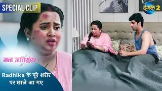 Mann Ati Sundar | Radhika के पूरे शरीर पर छाले आ गए | Dangal TV Special