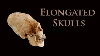 Elongated Skulls