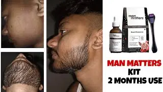 सिर्फ दो महीने में इस तरह दाढ़ी आ सकती हैं ? Man matters beard growth kit review | minoxidil beard 
