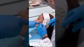 Transform Your Look with Expert Face Filler Treatment in Dubai