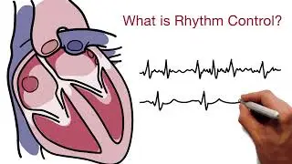 What is Rhythm Control?