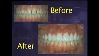(Spanish) BioTemps&reg; Provisionals
