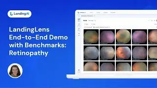 LandingLens Demo with Benchmarks | Retinopathy of Prematurity | Computer Vision Classification
