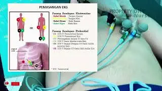 Pemasangan EKG