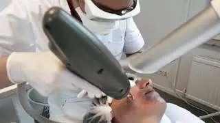 Fractional laserbehandeling voor huidverbetering of acnelittekens