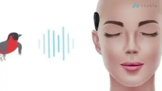 The Bold Cochlear Implant System | Neubio