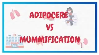 ADIPOCERE VS MUMMIFICATION | Postmortem changes | FMT | Hindi