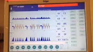 Drager SIMV dec comp