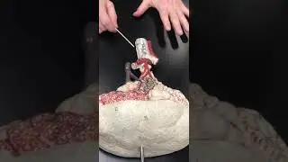 Bronchial Tree and Bronchiole &ldquo;Tree&rdquo; with Dr. Masi