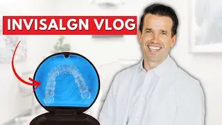 Invisalign VLOG and What the Orthodontist Sees...