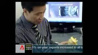 Spine Surgery - Singapore Orthopaedic Specialist - Dr Kevin Yip.flv