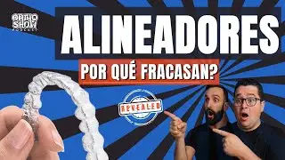La VERDAD sobre los ALINEADORES Dentales