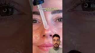 Пилинг от жирного блеска #WW139077 WB от Cosmeya #скинке #oilyskin #glowup #beautyroutine
