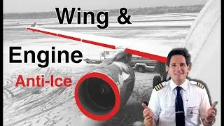 A320 / Anti-Ice System by CAPTAIN JOE