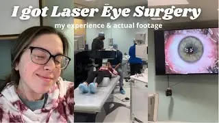 WHAT IT'S LIKE TO GET LASER EYE SURGERY | Advanced Surface Ablation (ASA)