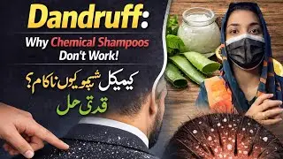 Dandruff: Why Chemical Shampoos don&rsquo;t work & Natural solutions | Chemical Shampoos don&rsquo;t work?
