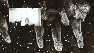 I Need It- Music Video (Microscopy Version)