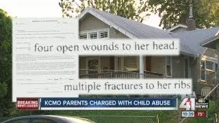 Parents of 2-year-old arrested on child abuse charges