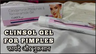 Clinsol Gel Review | Clinsol Gel | Clinsol Gel For Pimples | फायदे और नुकसान