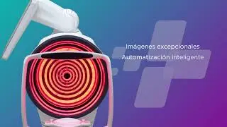TERA: Analizador Avanzado de Superficie Ocular Robotizado