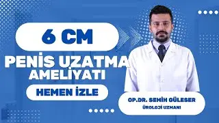 6 CM Penis Uzatma Ameliyatı; Op  Dr  Semih Güleser