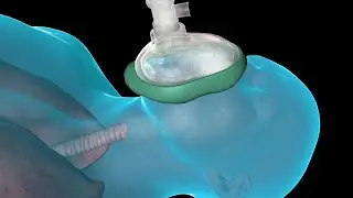 General Anesthesia at the Total Joint Center