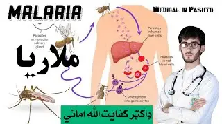 Malaria | د ملاريا ناروغي | Medical in Pashto | Infectious Disease | Kefayatullah Amani