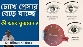 চোখে প্রেসার বেড়ে যাচ্ছে - কী ভাবে বুঝবেন ? How to Self Diagnose Pressure Increasing in Eye ?