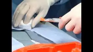 SANDEL&reg; Weighted Safety Scalpels