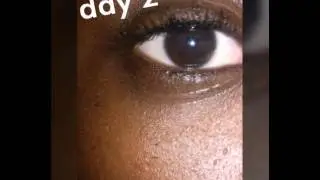 Week 1 update quadible integrity eye change into hazel