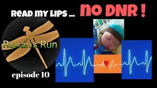 Read My Lips No DNR A Traumatic Brain Injury Story