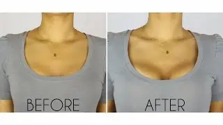 Boob Job or Good Bra? - UpBra