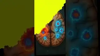RibbonFold: The AI That May Help Cure Alzheimer&rsquo;s #shorts