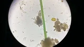 #Microbiology#Microorganisms under the microscope#Wonders