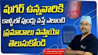 Diabetic Foot Problems Telugu | Diabetic Foot Ulcer | Preventing Amputations from Diabetes | Renova