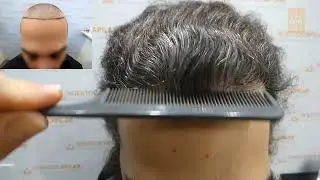 Restauracion de entradas con 2000 Uf