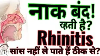 नाक जाम रहती है सांस लेने में दिक्कत आती है तो क्या करें//Respiratory System Activator//Homeo Remedy
