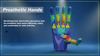 What Is Total Deformation in Prosthetics? | The Secret Behind Smart Hand Efficiency