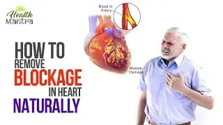 How to Remove blockage in heart naturally!