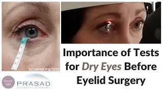 Importance of Testing for Dry Eyes Before Lower Eyelid Surgery