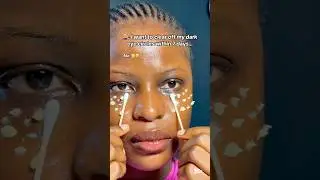 How to get rid of dark eye circles #skincareroutine #darkcircles #darkcircleseremoveal #eyebags