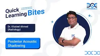 Radiology - Posterior Acoustic Shadowing by Dr. Khaleel Ahmed | NEET PG | DocTutorials.