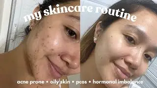 My Skincare Routine | Acne Probe, Oily Skin, PCOS & Hormonal Imbalance