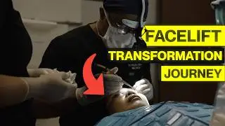 You WON'T BELIEVE Her Natural Browlift Transformation | Asian Facial Rejuvenation Journey