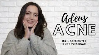 OS MELHORES INGREDIENTES & PRODUTOS ANTI-ACNE