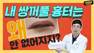 쌍꺼풀 수술 후 사라지지 않는 함몰 흉터, 절재 말고는 답이 없다? 닥터 김종규