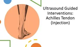 #ultrasound Guided Interventions: #Achilles Tendon (Injection) #fyp #sport #sports #sportsmedicine