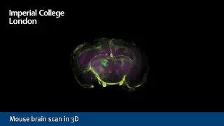 Mouse brain scan in 3D